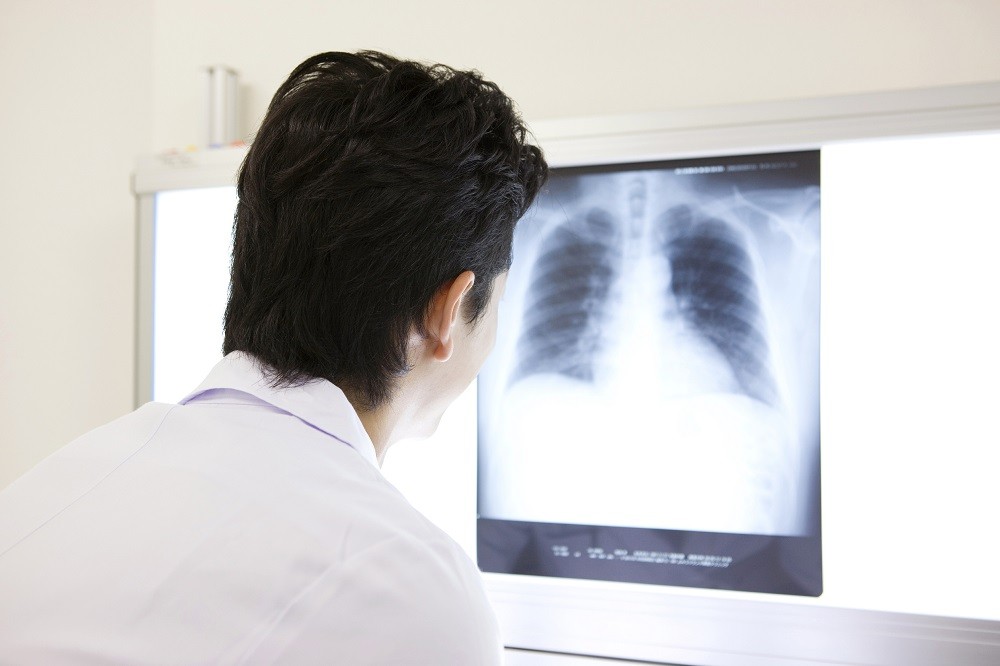 肺部CT.jpg