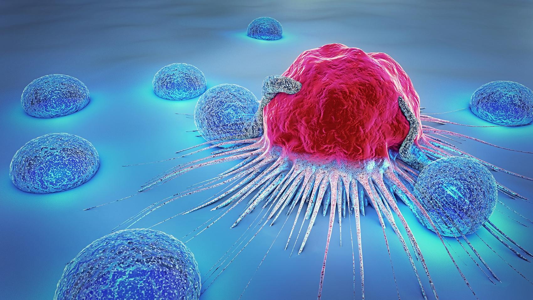 什么是原位癌？是恶性肿瘤还是良性肿瘤？ 